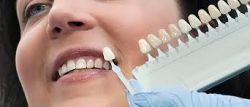 Periodontal Scaling And Root Planings