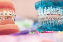 Miami Orthodontic Specialists