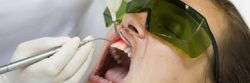 Periodontal Disease Treatment Houston