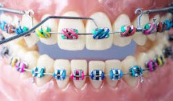 Comfort Dental Orthodontics