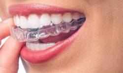 Choosing An Orthodontist For Invisalign
