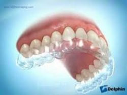 How To Clear Retainers After Braces