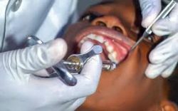 Emergency Dental Extraction Dentist