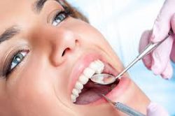 Dental Deep Cleaning Houston