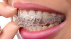 Invisalign Dentist