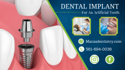 Replacement of a Single Missing Tooth