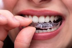 Denture Repairs Auckland