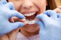 HOW YOU CAN FIND THE BEST RATED ORTHODONTIST NEAR ME IN MIAMI