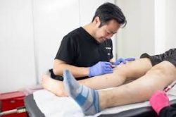 Varicose Veins Treatment Near Me