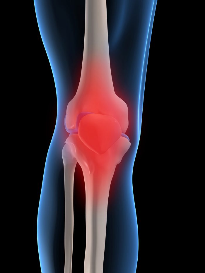 Is a Surgical Specialist Doctor for Knee Pain the Right Choice?
