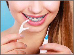 DENTAL BRACES FOR BETTER ORAL HEALTH