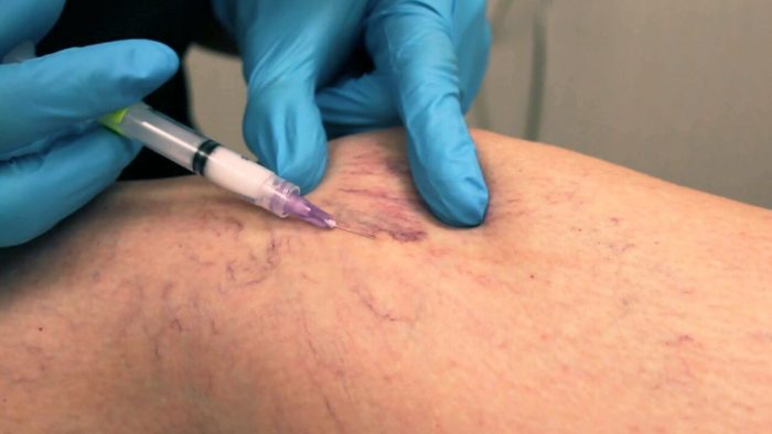 Harvard Trained Vein Doctor
