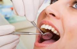 Dentist Near me for root canal