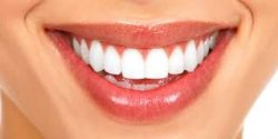 Affordable Teeth Whitening Dentist in Houston