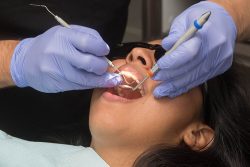 Dental Surgery in Houston