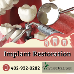 Implant Restorations to Retain Wellness