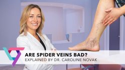 Veins Treatments Near Me