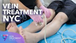 Vein Treatment Center Near Me