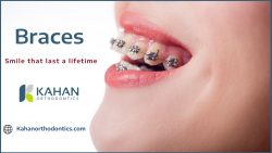 Orthodontic Braces to Straighten Your Teeth