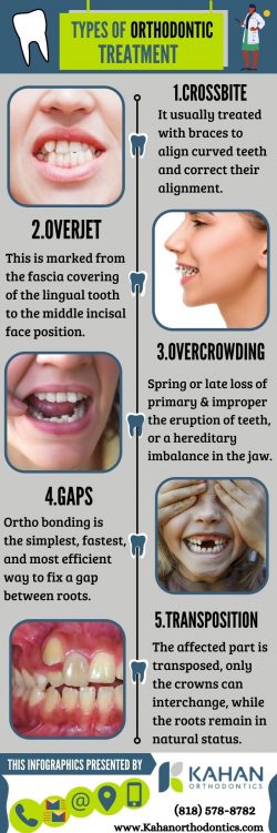 Orthodontic Treatment Options