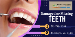 To Replace Missing Teeth in the Back of Your Mouth