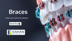 Achieve Your Perfect Smile with Braces