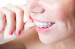 Orthodontic Options Aventura