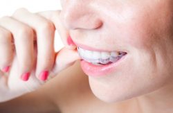 How To Find Orthodontic Treatment In Aventura, Fl?