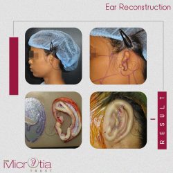 Best Ear Surgeon in Mumbai, India | Top Ear Surgeon