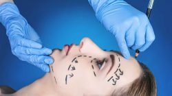 Best Oral and Maxillofacial Surgeon in Delhi