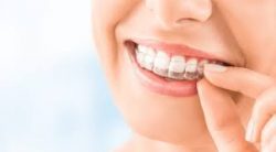 Invisalign Orthodontist Near Aventura Fl