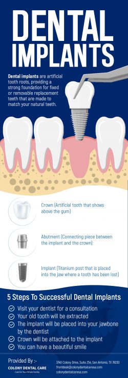 Colony Dental Care – Replace Your Missing Teeth with Dental Implants in San Antonio, TX