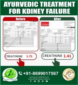 How to Prevent and Treat COVID-19 with Ayurveda