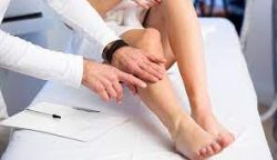 What are the best minimally invasive spider and varicose vein treatments?