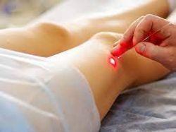 What happens during minimally invasive varicose veins treatment?