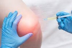 Knee Steroid Injections