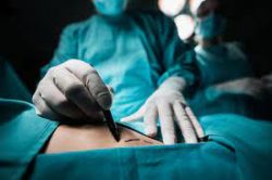 Surgical Treatments Are Costly