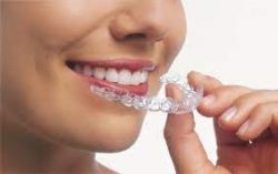 Orthodontic Options North Miami, Fl