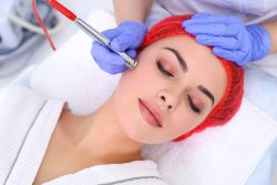 Acne Treatment in London South | EpicDermis