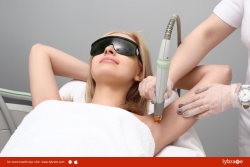 Laser Hair Removal Treatment