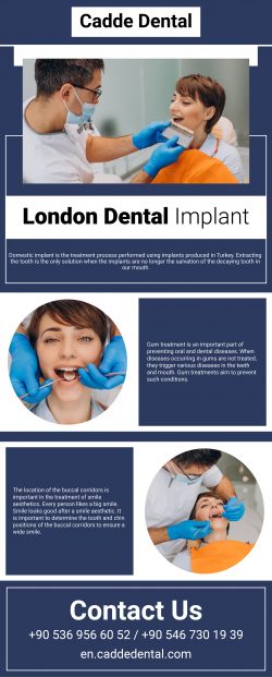 Find The Best London Dental Implant – Cadde Dental