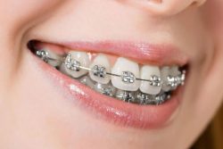 COST OF RETAINERS – CONSUMER INFORMATION