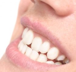 Types of Dental Retainers to Wear After Braces | Clear Retainers near me