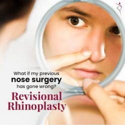 Rhinoplasty Surgeon in Dubai