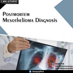 Postmortem Mesothelioma Diagnosis