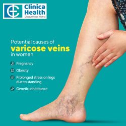 Expert Vascular Surgeon in Kolkata – Clinica Health