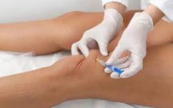 Knee Pain Relief: Surgical Treatment Options