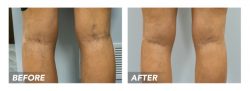 Vein & Skin Clinic Locations
