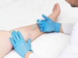 Vein Clinic | Harvard Trained Vein Doctors