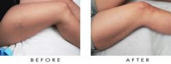 Harvard Trained Vein Doctor | Seeking Vein Treatment